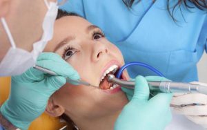 Dental Extraction