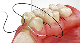 Oral and Facial Pathology