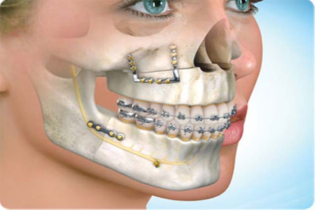 Oral and Facial trauma