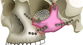 Oral and Facial Trauma